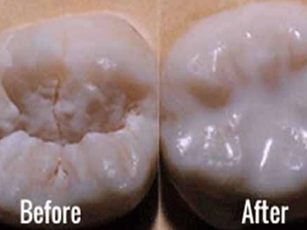 services sealants application before and after